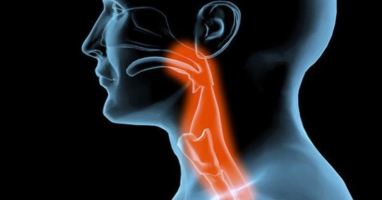 zapalenie migdałków