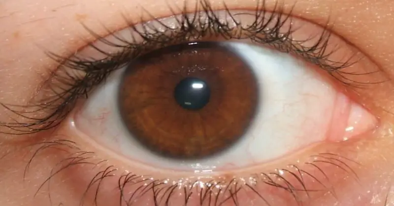 brązowe oczy
