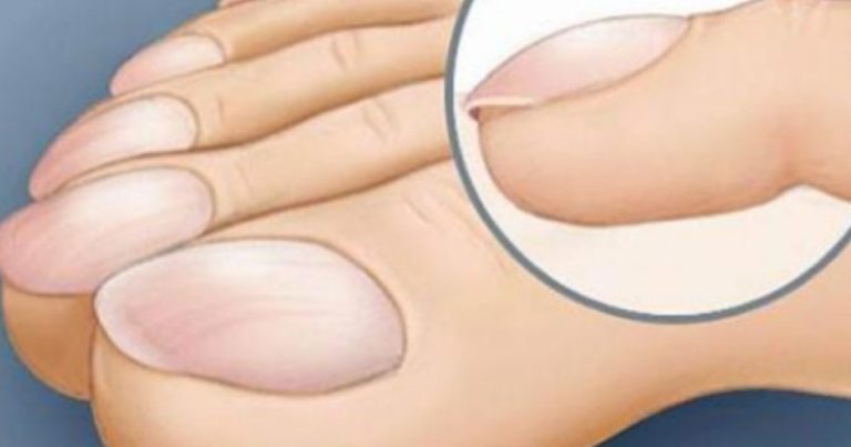 objawy uszkodzenia wątroby