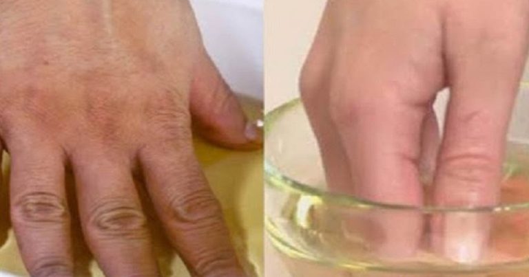 ból stawów ocet jabłkowy