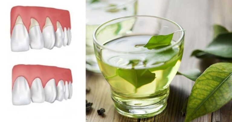 cofające się dziąsła