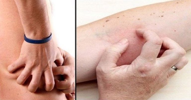 objawy uszkodzenia nerek