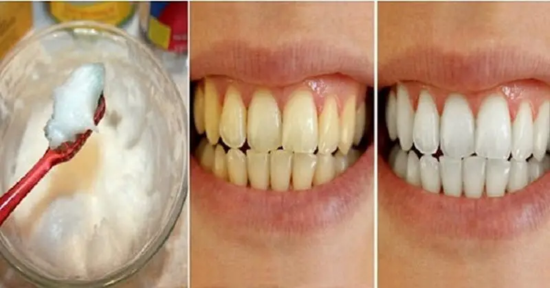 białe zęby