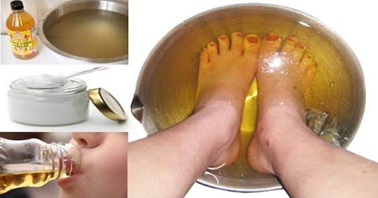 ocet jabłkowy zapalenie stawów