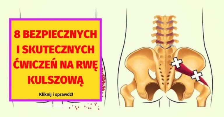 zastrzyki na rwę kulszową nazwy