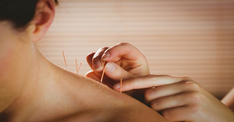 akupunktura pomaga leczyć bóle stawów