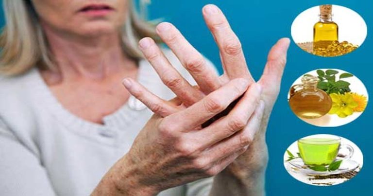 reumatoidalne zapalenie stawów