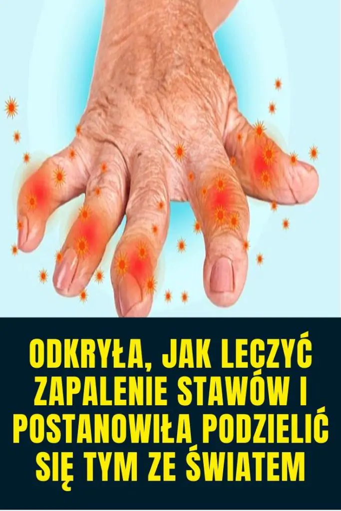 Odkryła, jak leczyć zapalenie stawów i postanowiła podzielić się tym ze