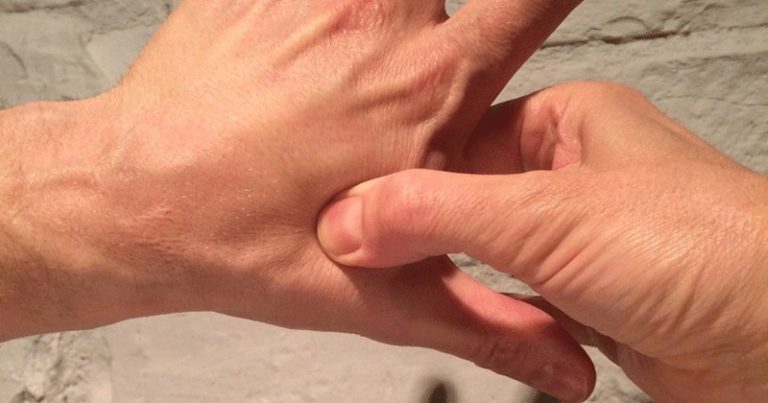 akupresura ból głowy