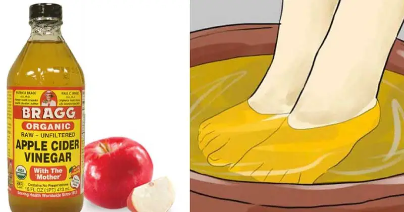 moczenie nóg ocet jabłkowy