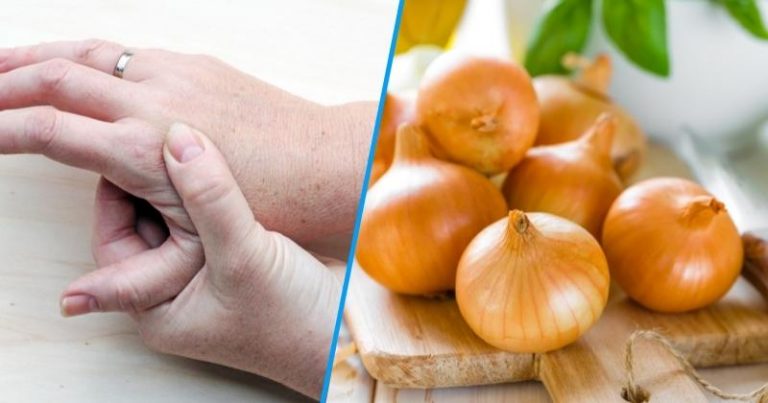 Jak użyć cebuli do usunięcia brodawek w domowym zaciszu?