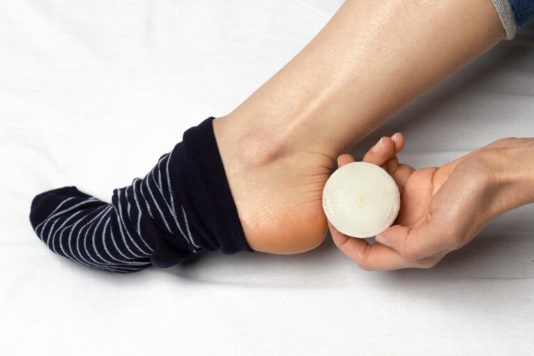 cebula w skarpetkach