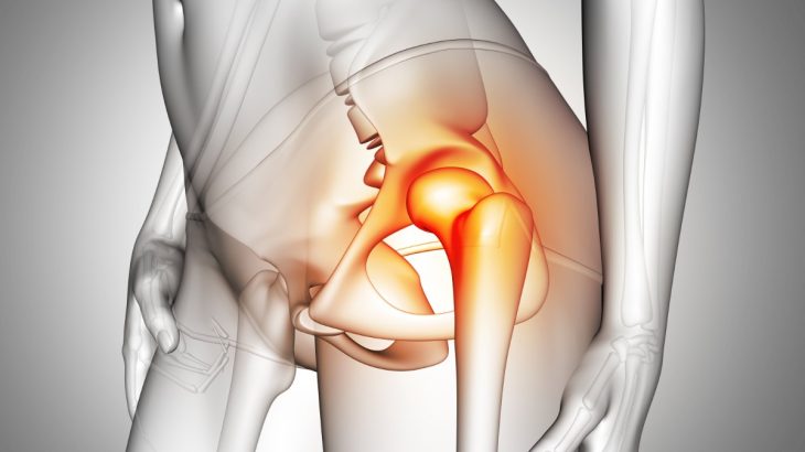 6 prostych ćwiczeń na ból kolan i bioder