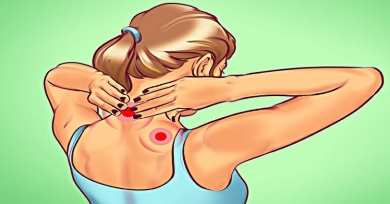 pozbyć się bólu szyi