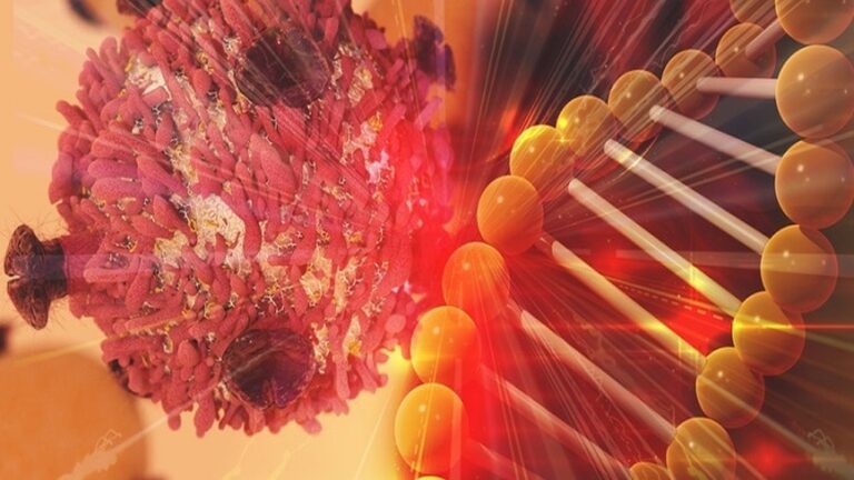 Szpiczak plazmocytowy