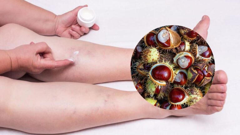 maść z kasztanowca na żylaki