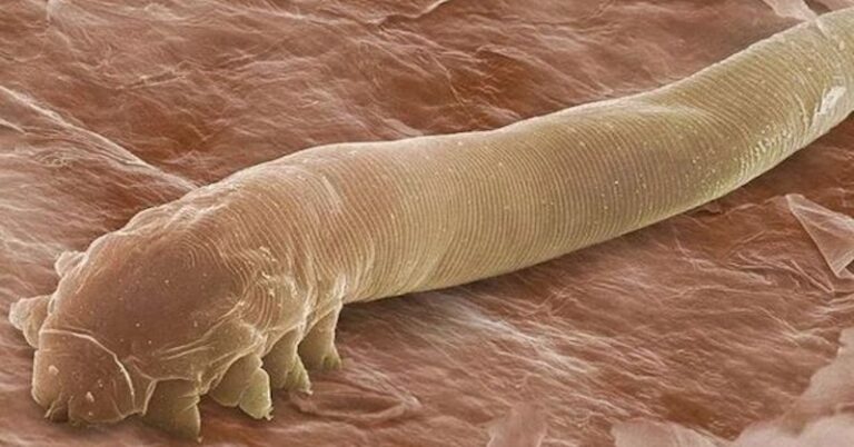 Oznaki obecności roztoczy