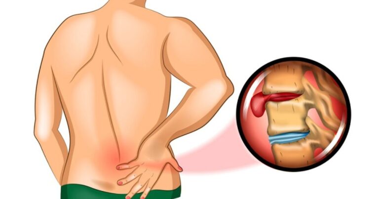 bolest-sedaciho-nervu-mi-doslova-nicila-zivot,-ani-chiropraktik-mi-nedokazal-pomoct-svete-div-se,-v-knizce-z-roku-1974-jsem-nasla-genialni-cvik.-pomohl-uz-za-5-minut