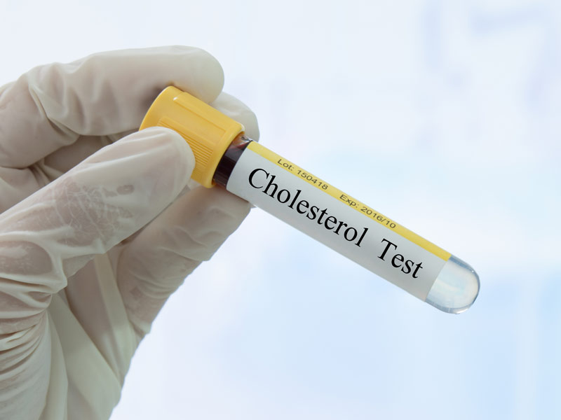 cholesterol